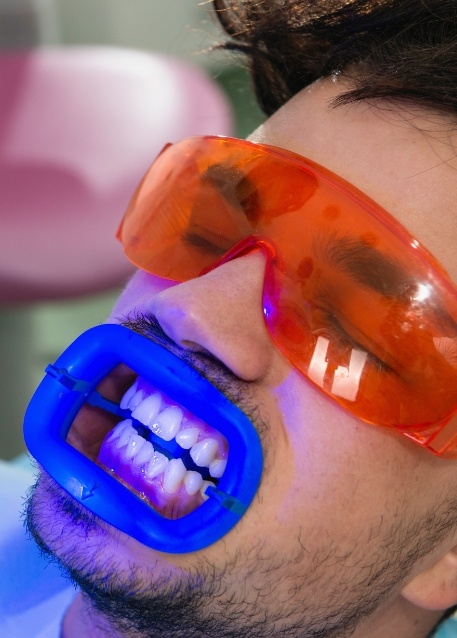 Dental patient getting his teeth professionally whitened