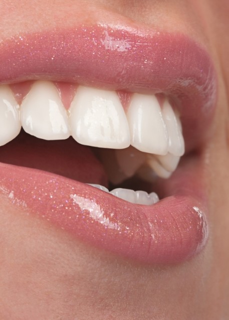 Close up of smile with flawless white teeth