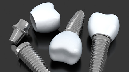 A dental implant in parts