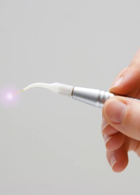 Hand holding a pen like dental laser device