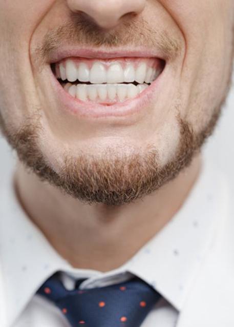 Close up of man showing off his teeth