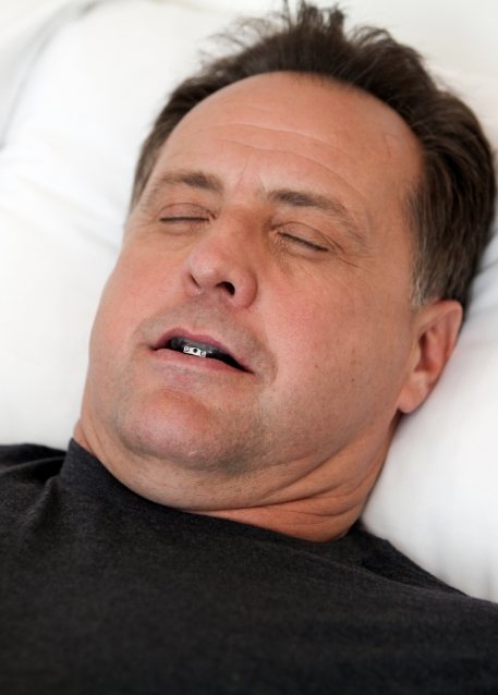 Man sleeping while wearing an oral appliance over his teeth